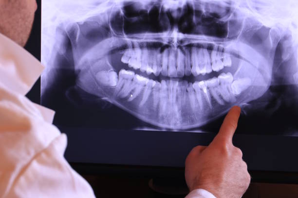 Best Emergency Dental Care for Broken or Chipped Teeth in Bernice, LA